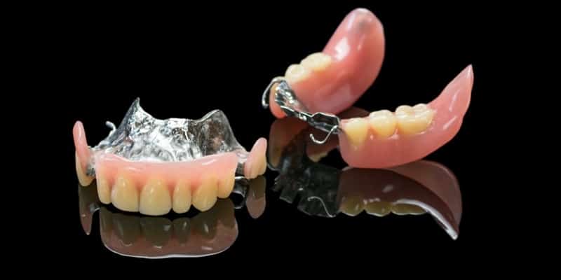 Pr tesis Removibles Tipos Y Cuidados Soluci n Dental Lima Per 