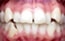 foto de estudios previos ortodoncia