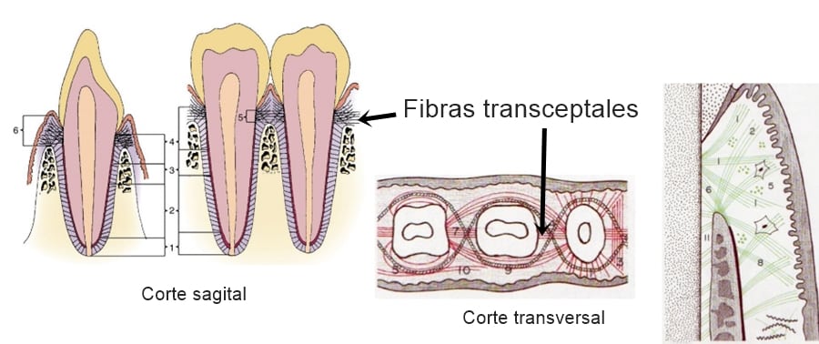 Fibras transceptales - fibrotomia supracrestal