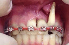 pésimo tratamiento ortodoncia