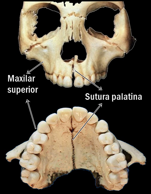 suturas-maxilar-para-expansion