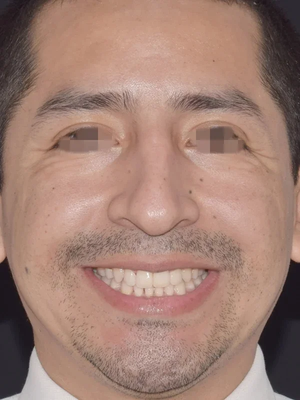 ortodoncia despues peru