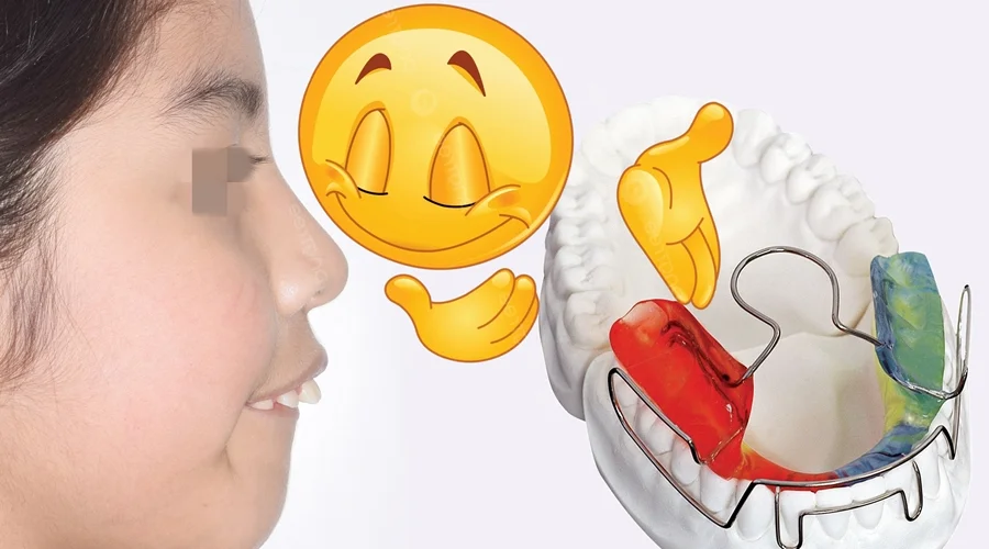 aparatos dentales para niños