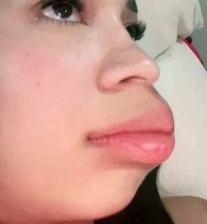 cara trompuda