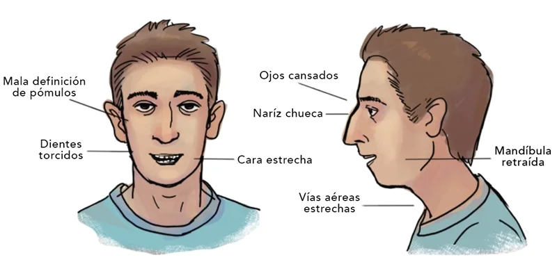 características del respirador oral