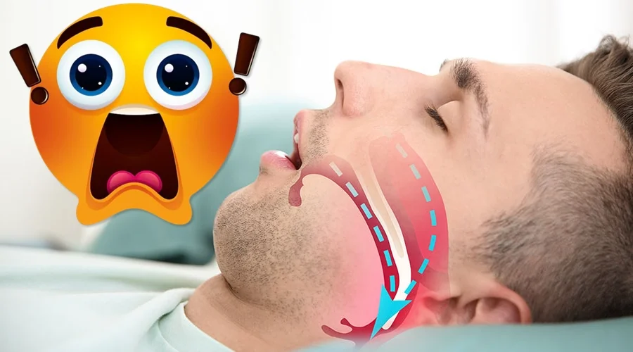 apnea del sueño y tratamiento de expansion maxilar