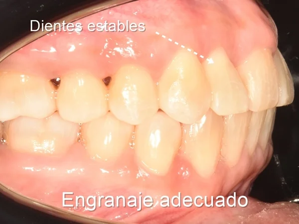 ortodoncia adultos lima peru