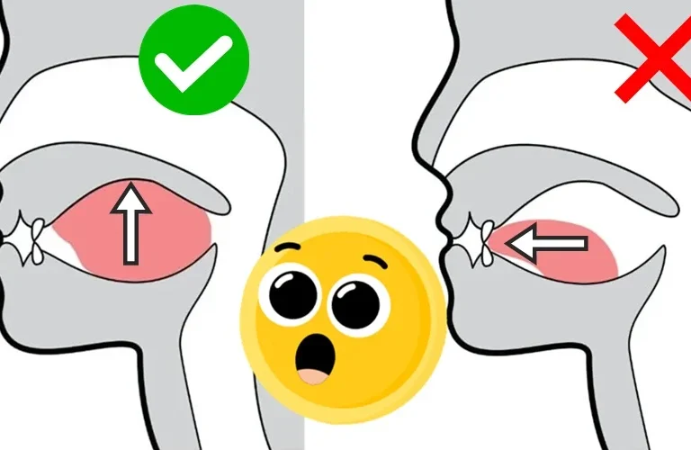 Mewing en ortodoncia